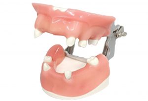Realistic Gingiva Dental Model for Tooth Loss Training
