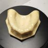 Implant Model