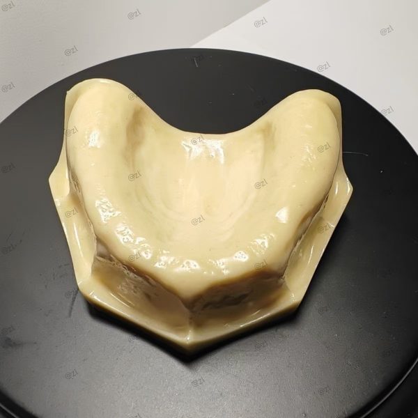 Implant Model