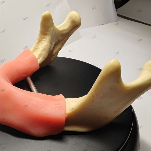 Dental Implant Training Mandible Model with Soft Gingiva