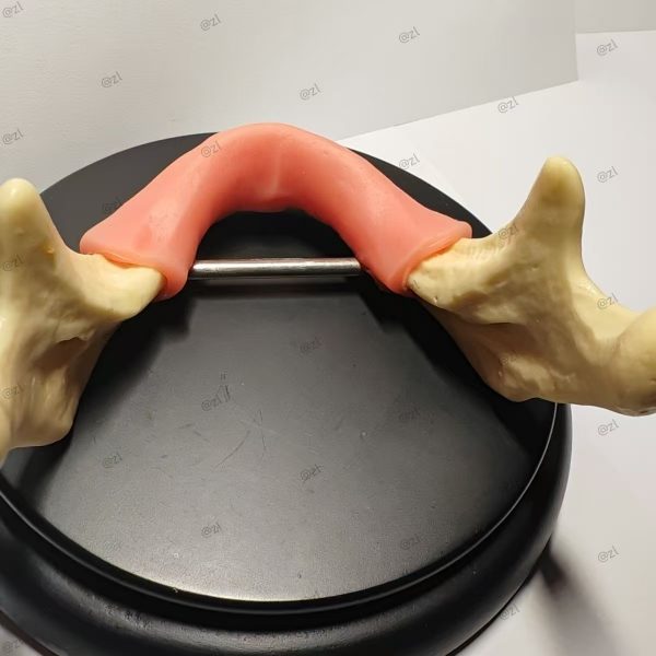 Dental Implant Training Mandible Model with Soft Gingiva