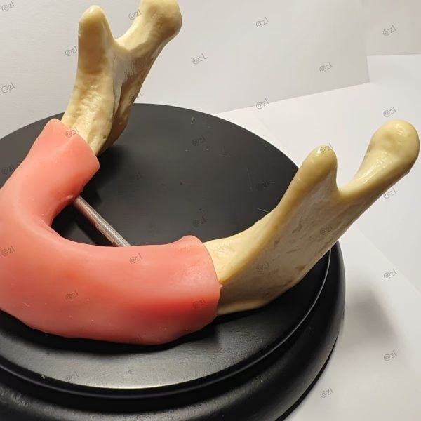 Dental Implant Training Mandible Model with Soft Gingiva
