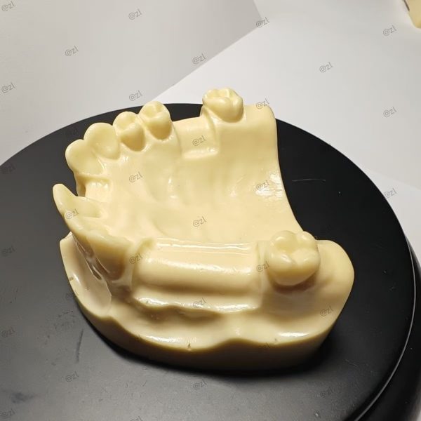 Side view of maxillary resin implant model with clear implant sockets and bone texture