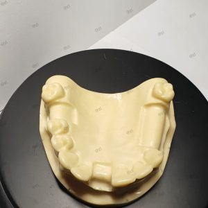 Front view of upper jaw dental implant training model showing bridge area and implant holes