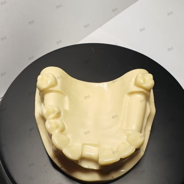 Front view of upper jaw dental implant training model showing bridge area and implant holes