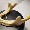 Side View of Mandible Implant Model Medical mandibular implant model side view highlighting the mandibular angle and ramus, ideal for dental implant training