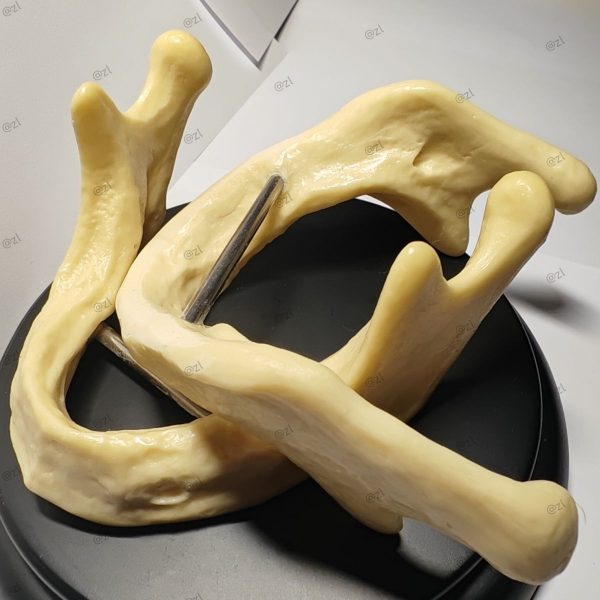 Top View of Mandible Dental Implant Model Top view of dental mandibular implant training model displaying bilateral ramus and mandibular body anatomical structure clearly