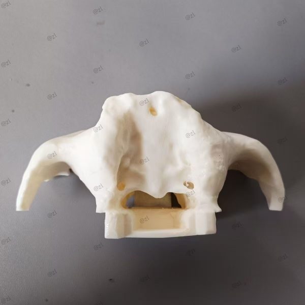 Zygomatic Implant Simulator