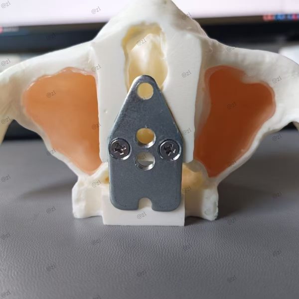 Zygomatic Implant Simulator