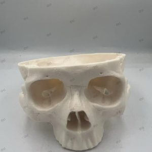 Surgical Skull