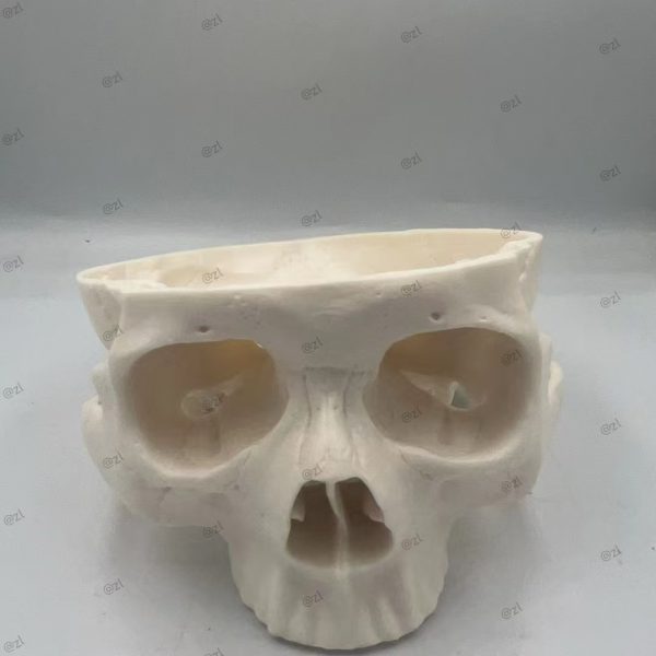 Surgical Skull