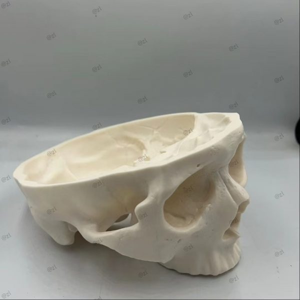 Surgical Skull