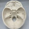 Surgical Skull