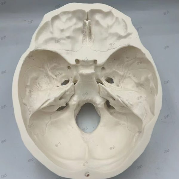 Surgical Skull