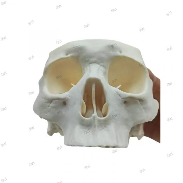Surgical Skull