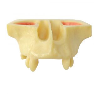 Frontal view of human sinus model showing nasal cavity and sinus structure