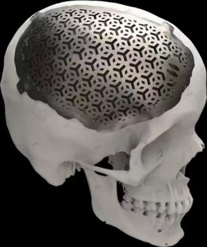 3D-Printed Skulls and Knee Joints in The Biomedical Field