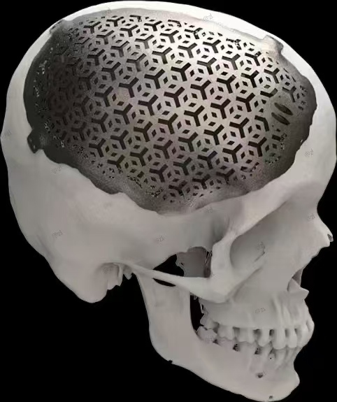 3D-Printed Skulls and Knee Joints in The Biomedical Field