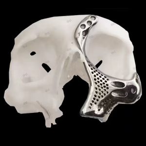 3D-Printed Skulls and Knee Joints in The Biomedical Field