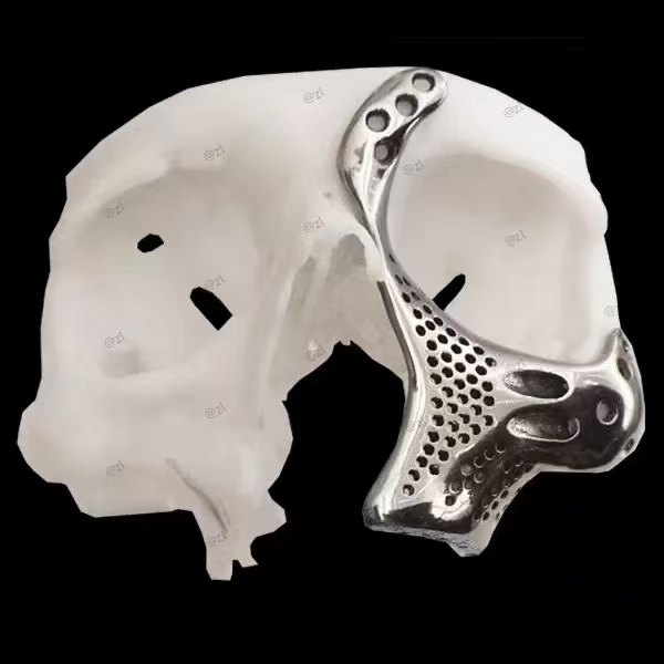 3D-Printed Skulls and Knee Joints in The Biomedical Field