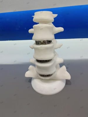 3D-Printed Skulls and Knee Joints in The Biomedical Field