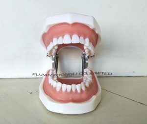 Prosthetic Restoration Typodont Teeth with Removable Screw Teeth