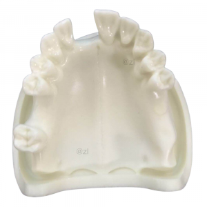 Upper Jaw Implant Model with Tooth Anatomy