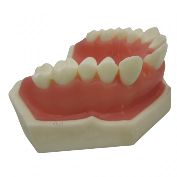 Side angle view of maxillary implant practice model with full teeth arrangement