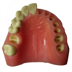 Maxillary dental implant model with partial dentition and realistic gum tissue