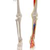 comparison of normal arm bones and arm with vessels