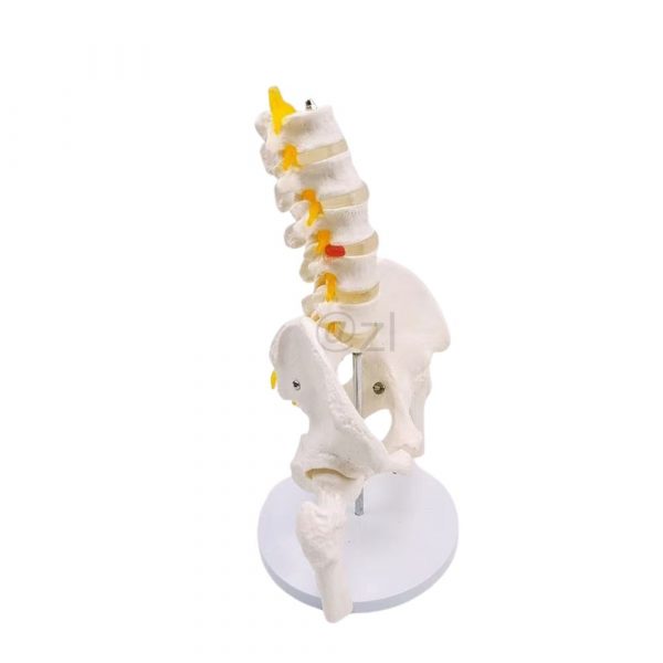 Rotated view showing spinal nerve roots and pelvis