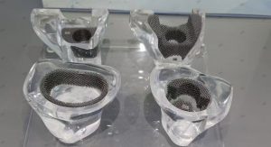 3D-Printed Skulls and Knee Joints in The Biomedical Field