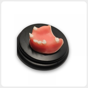 Half upper jaw implant model with soft gum on black base