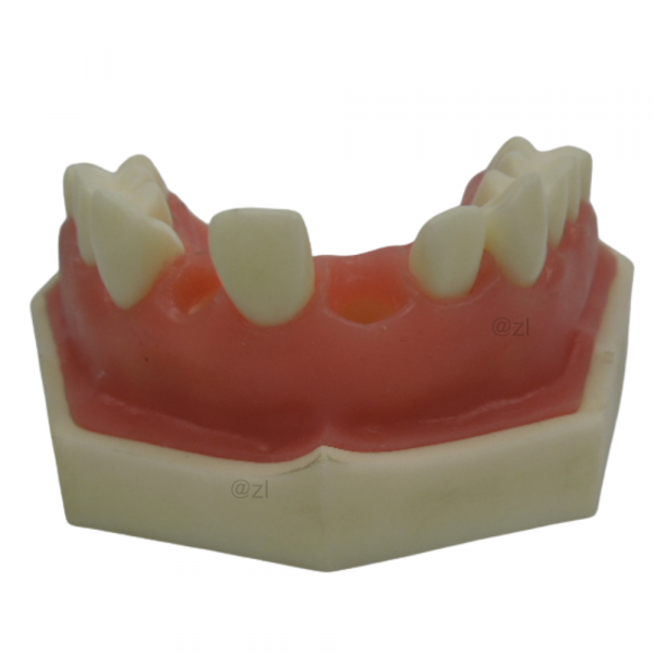 Frontal view of upper jaw implant training model showing open socket