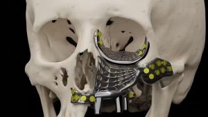 3D-Printed Skulls and Knee Joints in The Biomedical Field
