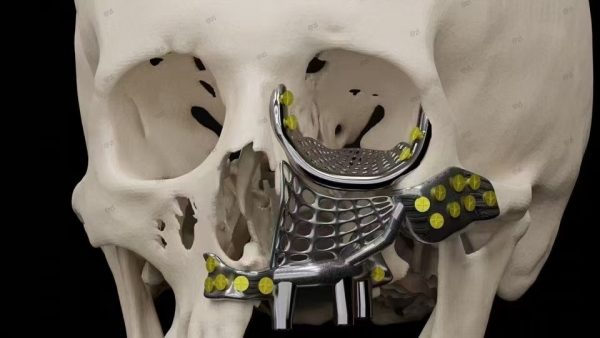 3D-Printed Skulls and Knee Joints in The Biomedical Field