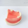 Dental implant training model – side view showing molars and soft gum
