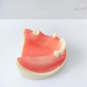 Dental implant training model – side view showing molars and soft gum