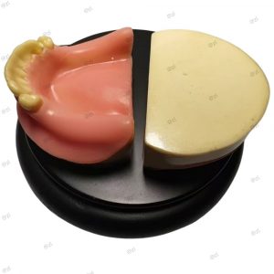 upper jaw dental implant model with partial teeth