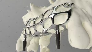 3D-Printed Skulls and Knee Joints in The Biomedical Field