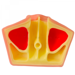 Upper jaw bone model with sinus cavity in red and yellow