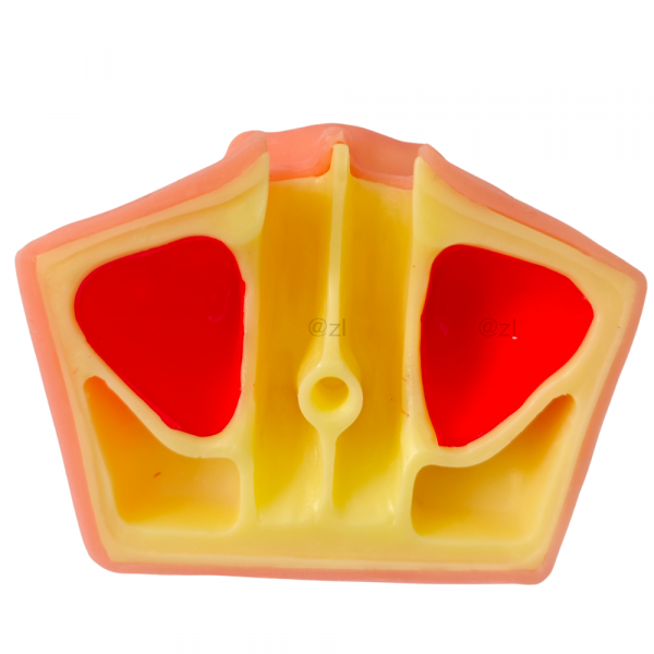 Upper jaw bone model with sinus cavity in red and yellow