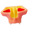 Sectional maxillary sinus lift model from posterior view