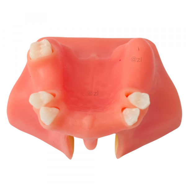 Frontal upper jaw model with incisors and molars