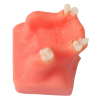 Top-view upper jaw dental model with edentulous molar sites