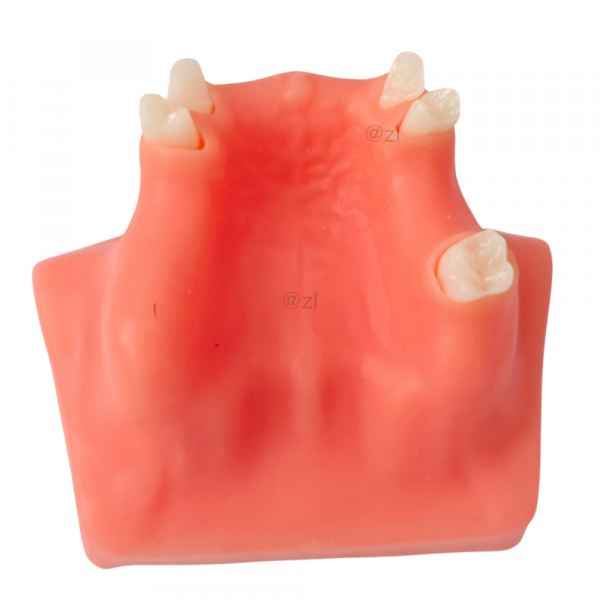 Upper jaw partial dentition model with gingiva simulation