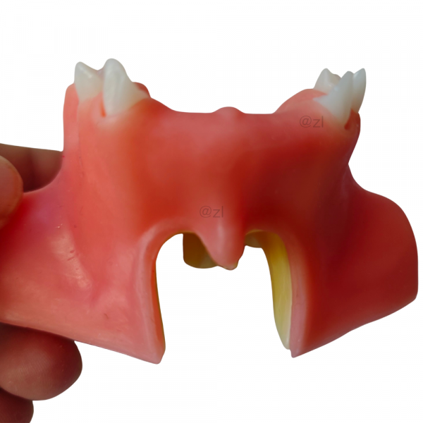Maxillary model showing nasal cavity base and anterior ridge