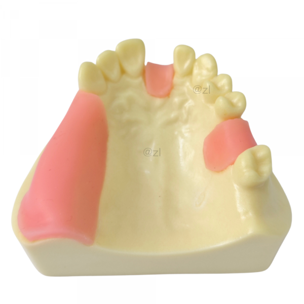 Dental Model with Partial Upper Arch Teeth and Gingiva for Prosthodontic Training