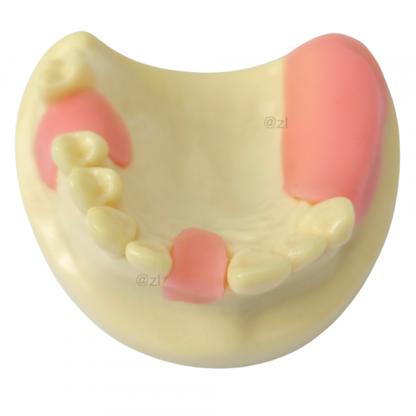 Occlusal View of Dental Training Model with Posterior Teeth and Gingival Areas