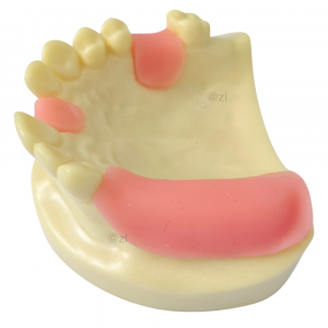Side View of Dental Upper Arch Model with Gingival Pads and Missing Teeth